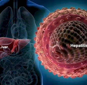 Kondisi Pasien Anak Suspek Hepatitis Akut di RSUP Wahidin Sudirohusodo Mulai Membaik
