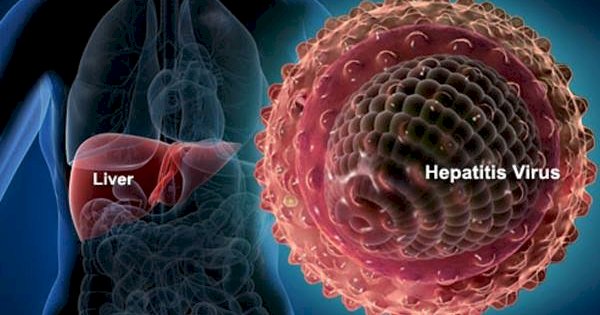 Kondisi Pasien Anak Suspek Hepatitis Akut di RSUP Wahidin Sudirohusodo Mulai Membaik