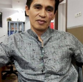 Rehabilitasi Gedung RSUD Daya, Hamzah Hamid Minta Pemkot Perhatikan Nakes