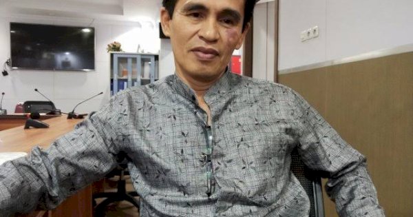 Rehabilitasi Gedung RSUD Daya, Hamzah Hamid Minta Pemkot Perhatikan Nakes