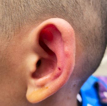 Damkar Makassar Evakuasi Sarang Lebah Usai Sengat Puluhan Murid SD Sudirman