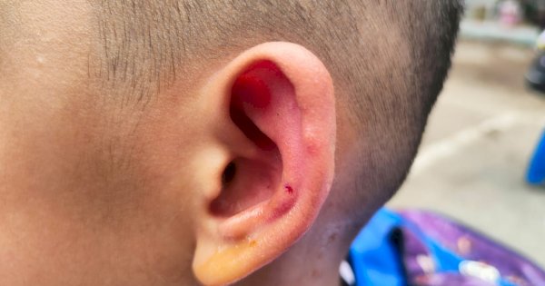 Damkar Makassar Evakuasi Sarang Lebah Usai Sengat Puluhan Murid SD Sudirman