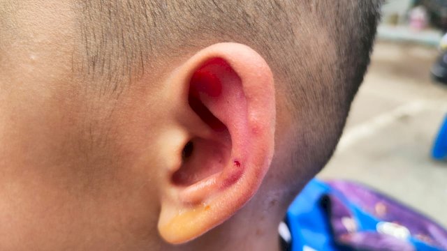 Damkar Makassar Evakuasi Sarang Lebah Usai Sengat Puluhan Murid SD Sudirman